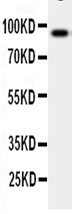 Anti-GCSF Receptor antibody, PA1906, Western blotting WB: Human Placenta Tissue Lysate