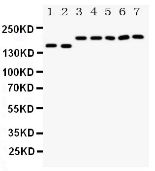 Anti-DCC antibody, PA1910, Western blotting Lane 1: Rat Brain Tissue Lysate Lane 2: Mouse Brain Tissue Lysate Lane 3: U87 Cell Lysate Lane 4: SW620 Cell Lysate Lane 5: COLO320 Cell Lysate Lane 6: 293T Cell Lysate Lane 7: HELA Cell Lysate