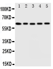 Anti-Iduronate 2 sulfatase antibody, PA1917, Western blotting Lane 1: HELA Cell Lysate Lane 2: SMMC Cell Lysate Lane 3: A549 Cell Lysate Lane 4: MCF-7 Cell Lysate Lane 5: COLO Cell Lysate