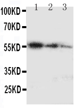 Anti-Ki67 antibody, PA1918, Western blotting Recombinant Protein Detection Source: E.coli derived -recombinant Human Ki67 50.3KD