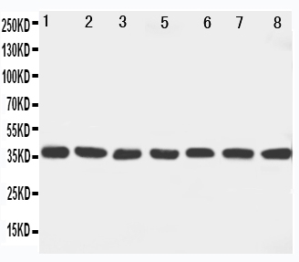 Anti-MEK6 antibody, PA1921, Western blotting Lane 1: Rat Ovary Tissue Lysate Lane 2: Rat Spleen Tissue Lysate Lane 3: Rat Brain Tissue Lysate Lane 4: Rat Heart Tissue Lysate Lane 5: NIH3I3 Cell Lysate Lane 6: HELA Cell Lysate Lane 7: JRUKAT Cell Lysate