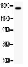 Anti-MEKK1 antibody, PA1923, Western blotting All lanes: Anti MEKK1 (PA1923) at 0.5ug/ml WB: MCF-7 Whole Cell Lysate at 40ug Predicted bind size: 164KD Observed bind size: 164KD