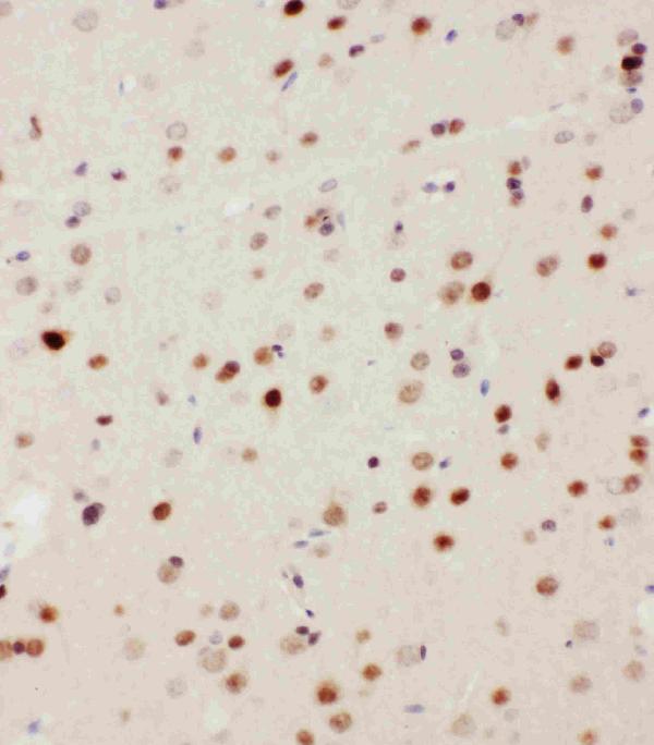 Anti-MEKK3 antibody, PA1925, IHC(P) IHC(P): Rat Brain Tissue