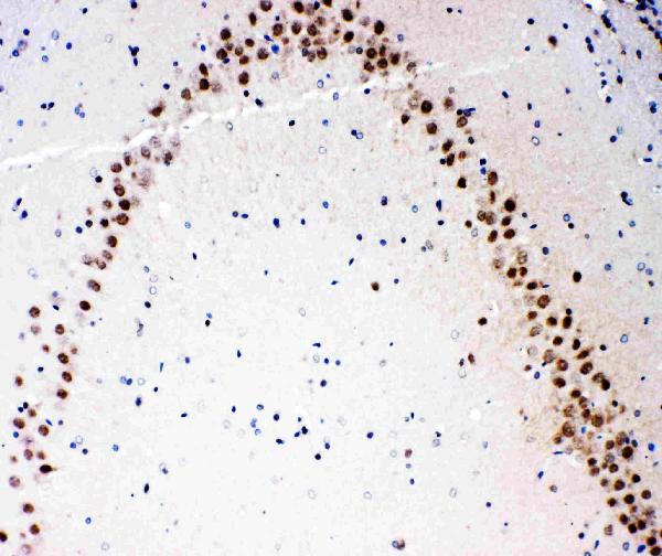 Anti-MEKK3 antibody, PA1925, IHC(P) IHC(P): Rat Brain Tissue