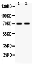 Anti-MEKK3 antibody, PA1925, Western blotting All lanes: Anti MAP3K3 (PA1925) at 0.5ug/ml Lane 1: Rat Brain Tissue Lysate at 50ug Lane 2: Mouse Brain Tissue Lysate at 50ug Predicted bind size: 71KD Observed bind size: 71KD