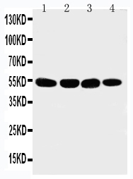 Anti-Matrilin 3 antibody, PA1927, Western blotting Lane 1: 293T Cell Lysate Lane 2: COLO320 Cell Lysate Lane 3: HELA Cell Lysate Lane 4: A549 Cell Lysate