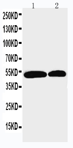 Anti-NOXA1 antibody, PA1930, Western blotting Lane 1: U87 Cell Lysate Lane 2: HELA Cell Lysate