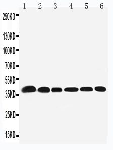 Western blot analysis of Nucleophosmin using anti-Nucleophosmin antibody (PA1931).