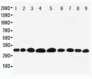 Anti-Prohibitin antibody, PA1932, Western blotting Lane 1: Rat Lung Tissue Lysate Lane 2: Rat Skeletal Muscle Tissue Lysate Lane 3: Rat Brain Tissue Lysate Lane 4: Rat Kidney Tissue Lysate Lane 5: HELA Cell Lysate Lane 6: MCF-7 Cell Lysate Lane 7: PC-12 Cell Lysate Lane 8: A549 Cell Lysate Lane 9: SMMC Cell Lysate