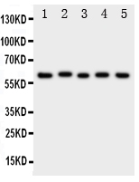 Western blot analysis of ASIC3 using anti-ASIC3 antibody (PA1938). Electrophoresis was performed on a 5-20% SDS-PAGE gel at 70V (Stacking gel) / 90V (Resolving gel) for 2-3 hours. The sample well of each lane was loaded with 50ug of sample under reducing conditions. Lane 1: Rat Brain Tissue Lysate, Lane 2: Rat Testis Tissue Lysate, Lane 3: U87 Cell Lysate, Lane 4: NEURO Cell Lysate, Lane 5: SMMC Cell Lysate. After Electrophoresis, proteins were transferred to a Nitrocellulose membrane at 150mA for 50-90 minutes. Blocked the membrane with 5% Non-fat Milk/ TBS for 1.5 hour at RT. The membrane was incubated with rabbit anti-ASIC3 antigen affinity purified polyclonal antibody (Catalog # PA1938) at 0.5 μg/mL overnight at 4°C, then washed with TBS-0.1%Tween 3 times with 5 minutes each and probed with a goat anti-rabbit IgG-HRP secondary antibody at a dilution of 1:10000 for 1.5 hour at RT. The signal is developed using an Enhanced Chemiluminescent detection (ECL) kit (Catalog # EK1002) with Tanon 5200 system. A specific band was detected for ASIC3 at approximately 69KD. The expected band size for ASIC3 is at 58KD.