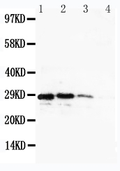 Anti-CUEDC2 antibody, PA1962, Western blotting Recombinant Protein Detection Source: E.coli derived -recombinant human CuEDC2, 28.9KD