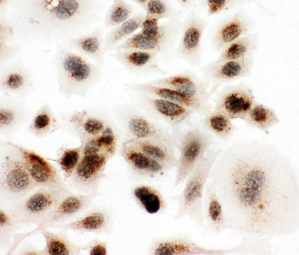 Anti-DDX4/MVH antibody, PA1963, ICC ICC: MCF-7 Cell