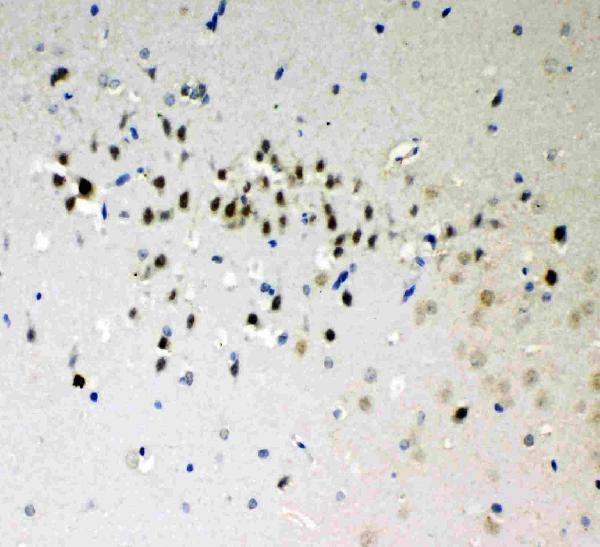 Anti-DDX5 antibody, PA1964, IHC(P) IHC(P): Rat Brain Tissue