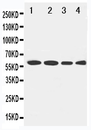 Anti-LCAT antibody, PA1967, Western blotting Lane 1: Rat Brain Tissue Lysate Lane 2: U87 Cell Lysate Lane 3: HELA Cell Lysate Lane 4: SMMC Cell Lysate