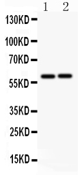 Anti-LTBR antibody, PA1968, Western blotting All lanes: Anti LTBR (PA1968) at 0.5ug/ml Lane 1: HELA Whole Cell Lysate at 40ug Lane 2: A549 Whole Cell Lysate at 40ug Predicted bind size: 47KD Observed bind size: 60KD