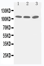 Anti-Zonula occludens protein 3 antibody, PA1972, Western blotting Lane 1: PANC Cell Lysate Lane 2: A549 Cell Lysate Lane 3: HELA Cell Lysate