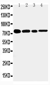 Anti-TNF Receptor II antibody, PA1974, Western blotting Lane 1: Rat Spleen Tissue Lysate Lane 2: Rat Brain Tissue Lysate Lane 3: Mouse Brain Tissue Lysate Lane 4: HEPA Cell Lysate