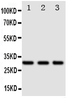 Anti-DR4 antibody, PA1975, Western blotting Lane 1: SW620 Cell Lysate Lane 2: COLO320 Cell Lysate Lane 3: HT1080 Cell Lysate