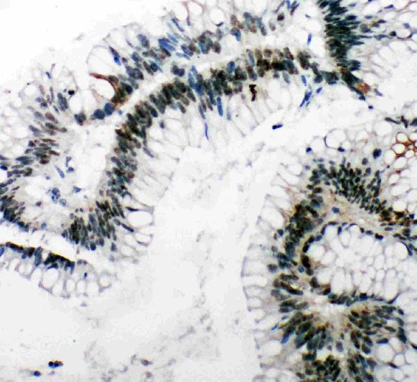 IHC analysis of TP53BP1 using anti-TP53BP1 antibody (PA1976).