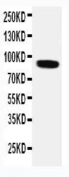 Anti-VRL1 antibody, PA1977, Western blotting WB: HELA Cell Lysate