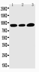 Anti-TRPV3 antibody, PA1978, Western blotting Lane 1: HELA Cell Lysate Lane 2: A549 Cell Lysate Lane 3: MCF-7 Cell Lysate