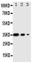 Anti-Wnt2b antibody, PA1985, Western blotting Recombinant Protein Detection Source :E.coli derived -recombinant Human WNT2B, 35.78KD