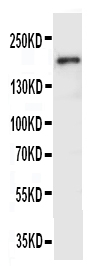 Anti-VEGF Receptor 2 antibody, PA1989, Western blotting WB: SMMC Cell Lysate