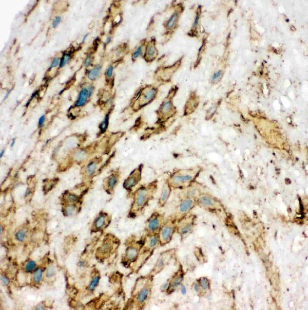 Anti-VEGF Receptor 2 antibody, PA1989, IHC(F) IHC(F): Human Placenta Tissue