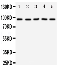 Anti-TrkC antibody, PA1992-1, Western blotting Lane 1: Rat Brain Tissue Lysate Lane 2: Mouse Brain Tissue Lysate Lane 3: U87 Cell Lysate Lane 4: SHG Cell Lysate Lane 5: NEURO Cell Lysate