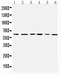 Anti-Mitochondrial Pyruvate dehydrogenase kinase 1 antibody, PA1993, Western blotting Lane 1: Rat Heart Tissue Lysate Lane 2: Rat Skeletal Muscle Tissue Lysate Lane 3: HELA Cell Lysate Lane 4: M231 Cell Lysate Lane 5: COLO320 Cell Lysate Lane 6: SW620 Cell Lysate