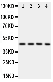 Anti-PDK2 antibody, PA1994, Western blotting Lane 1: Rat Heart Tissue Lysate Lane 2: HELA Cell Lysate Lane 3: SW620 Cell Lysate Lane 4: MCF-7 Cell Lysate