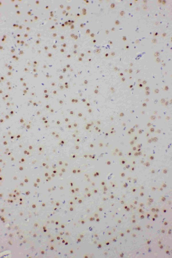 Anti-PDK2 antibody, PA1994, IHC(P) IHC(P): Rat Brain Tissue