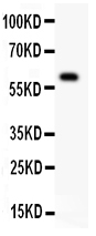 Anti-DR3 antibody, PA2004, Western blotting All lanes: Anti DR3 (PA2004) at 0.5ug/ml WB: COLO320 Whole Cell Lysate at 40ug Predicted bind size: 59KD Observed bind size: 59KD