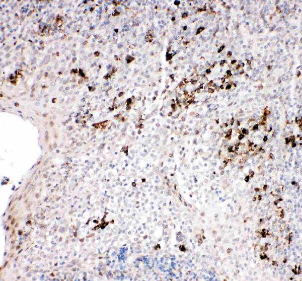 Anti-TRAF2 antibody, PA2007, IHC(P) IHC(P): Human Tonsil Tissue