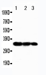 Anti-TRAF3 antibody, PA2008, Western blotting Recombinant Protein Detection Source: E.coli derived -recombinant Human TRAF3, 30.6KD