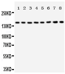 Anti-Hamartin antibody, PA2012, Western blotting All lanes: Anti Hamartin (PA2012) at 0.5ug/ml Lane 1: Rat Skeletal Muscle Tissue Lysate at 50ug Lane 2: Rat Heart Tissue Lysate at 50ug Lane 3: Rat Brain Tissue Lysate at 50ug Lane 4: Rat Lung Tissue Lysate at 50ug Lane 5: 293T Whole Cell Lysate at 40ug Lane 6: HELA Whole Cell Lysate at 40ug Lane 7: HT1080 Whole Cell Lysate at 40ug Lane 8: SMMC Whole Cell Lysate at 40ug Predicted bind size: 130KD Observed bind size: 160KD