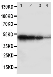 Anti-BMPR1B antibody, PA2017, Western blotting Recombinant Protein Detection Source: E.coli derived -recombinant Human BMPR1B, 49.0KD