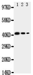 Anti-CD68 antibody, PA2018, Western blotting Recombinant Protein Detection Source: E.coli derived -recombinant Human CD68, 42.5KD