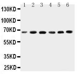 Anti-CETP antibody, PA2019, Western blotting Lane 1: HELA Cell Lysate Lane 2: COLO320 Cell Lysate Lane 3: HT1080 Cell Lysate Lane 4: JURKAT Cell Lysate Lane 5: RAJI Cell Lysate Lane 6: MCF-7 Cell Lysate