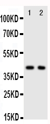 Anti-CXCR5 antibody, PA2021, Western blotting Lane 1: Rat Spleen Tissue Lysate Lane 2: HELA Cell Lysate