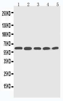 Anti-CYP2U1 antibody, PA2022, Western blotting Lane 1: HELA Cell Lysate Lane 2: MCF-7 Cell Lysate Lane 3: MM453 Cell Lysate Lane 4: COLO320 Cell Lysate Lane 5: HT1080 Cell Lysate