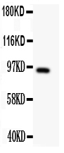 Western blot analysis of DISC1 using anti-DISC1 antibody (PA2023-1). Electrophoresis was performed on a 5-20% SDS-PAGE gel at 70V (Stacking gel) / 90V (Resolving gel) for 2-3 hours. The sample well of each lane was loaded with 50ug of sample under reducing conditions. Lane 1: U87 Whole Cell Lysate. After Electrophoresis, proteins were transferred to a Nitrocellulose membrane at 150mA for 50-90 minutes. Blocked the membrane with 5% Non-fat Milk/ TBS for 1.5 hour at RT. The membrane was incubated with rabbit anti-DISC1antigen affinity purified polyclonal antibody (Catalog # PA2023-1) at 0.5 μg/mL overnight at 4°C, then washed with TBS-0.1%Tween 3 times with 5 minutes each and probed with a goat anti-rabbit IgG-HRP secondary antibody at a dilution of 1:10000 for 1.5 hour at RT. The signal is developed using an Enhanced Chemiluminescent detection (ECL) kit (Catalog # EK1002) with Tanon 5200 system. A specific band was detected for DISC1 at approximately 94KD. The expected band size for DISC1 is at 94KD.