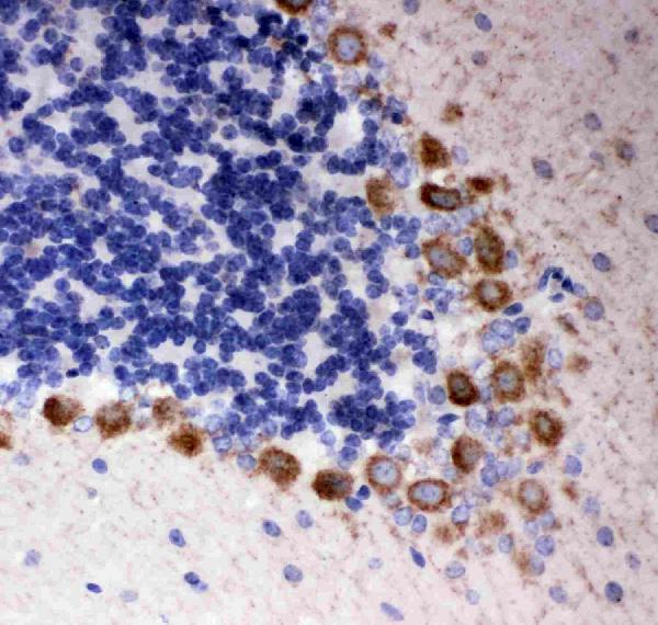 IHC analysis of DISC1using anti-DISC1 antibody (PA2023-1). DISC1 was detected in paraffin-embedded section of rat cerebellum tissues. Heat mediated antigen retrieval was performed in citrate buffer (pH6, epitope retrieval solution) for 20 mins. The tissue section was blocked with 10% goat serum. The tissue section was then incubated with 1μg/ml rabbit anti-DISC1 Antibody (PA2023-1) overnight at 4°C. Biotinylated goat anti-rabbit IgG was used as secondary antibody and incubated for 30 minutes at 37°C. The tissue section was developed using Strepavidin-Biotin-Complex (SABC)(Catalog # SA1022) with DAB as the chromogen.