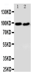 Anti-DISC1 antibody, PA2023, Western blotting Lane 1: U87 Cell Lysate Lane 2: SHG Cell Lysate