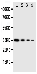 Anti-PKR antibody, PA2025, Western blotting Recombinant Protein Detection Source: E.coli derived -recombinant Human EIF2AK2, 35.0KD