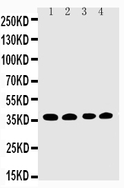 Anti-EIF2S1 antibody, PA2029, Western blotting Lane 1: COLO320 Cell Lysate Lane 2: CEM Cell Lysate Lane 3: RAJI Cell Lysate Lane 4: HT1080 Cell Lysate