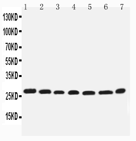 Anti-EIF6 antibody, PA2031, Western blotting Lane 1: Rat Liver Tissue Lysate Lane 2: Rat Kidney Tissue Lysate Lane 3: COLO320 Cell Lysate Lane 4: SW620 Cell Lysate Lane 5: HELA Cell Lysate Lane 6: 293T Cell Lysate