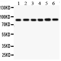 Anti-IKBKB antibody, PA2036-1, Western blotting All lanes: Anti IKBKB (PA2036-1) at 0.5ug/ml Lane 1: Rat Cardiac Muscle Tissue Lysate at 50ug Lane 2: Rat Skeletal Muscle Tissue Lysate at 50ug Lane 3: PANC Whole Cell Lysate at 40ug Lane 4: MCF-7Whole Cell Lysate at 40ug Lane 5: HEPG2 Whole Cell Lysate at 40ug Lane 6: COLO320 Cell Lysate at 40ug Predicted bind size: 87KD Observed bind size: 87KD