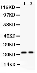 Anti-IL-18 antibody, PA2037, Western blotting All lanes: Anti IL-18 (PA2037) at 0.5ug/ml Lane 1: HELA Whole Cell Lysate at 40ug Lane 2: Human Placenta Tissue Lysate at 50ug Predicted bind size: 22KD Observed bind size: 22KD