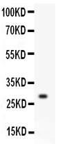 Anti-Kallikrein 1 antibody, PA2038,Western blotting All lanes: Anti Kallikrein 1 (PA2038) at 0.5ug/ml WB: Mouse Testis Tissue Lysate at 50ug Predicted bind size: 29KD Observed bind size: 29KD